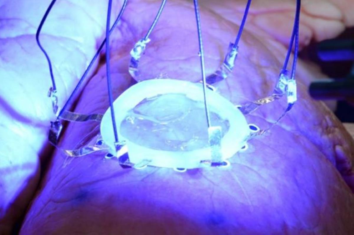 Crean sensor que puede ser implantado en órganos con impresión 3D