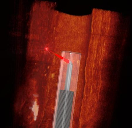 camara miniatura para ver dentro de vasos sanguineos