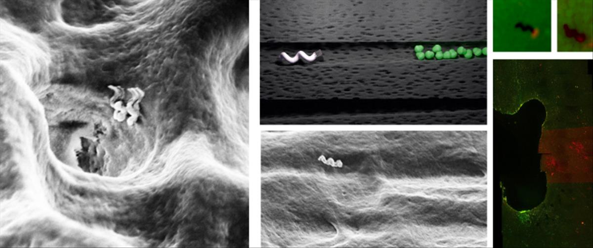 Científicos crean nanobots capaces de matar las bacterias del interior de los dientes con calor