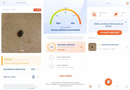 detectar manchas de la piel