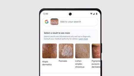 Google Lens usa IA para identificar afecciones de la piel