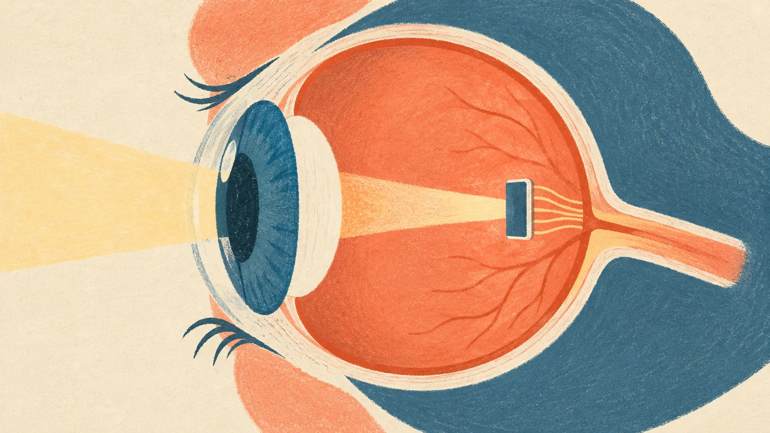 Science Corp: un paciente con Stargardt vuelve a leer una palabra gracias al implante retinal PRIMA